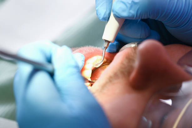 Best Broken Tooth Emergency  in Fairfax, SC