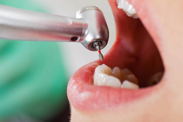 Best Dentist for Severe Toothache  in Fairfax, SC